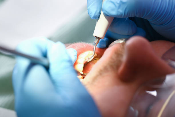 Best Emergency Tooth Extraction in Landmk, AR