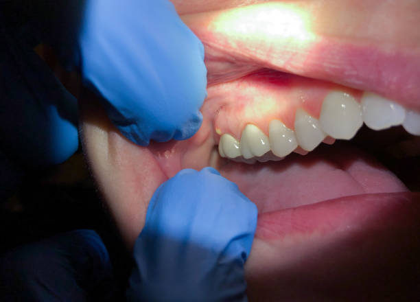 Best Emergency Broken Tooth Repair in Landmk, AR